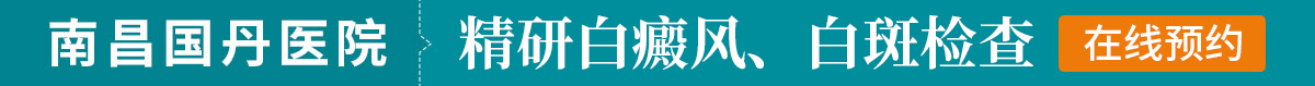 南昌专业治疗白癜风