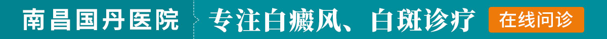 南昌专业治疗白癜风